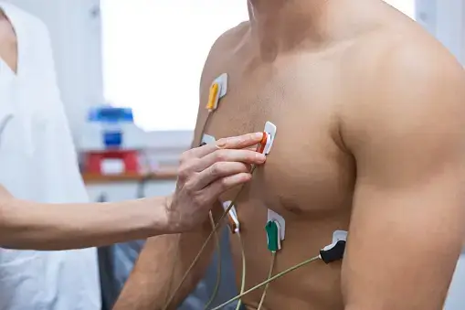 electrocardiograma
